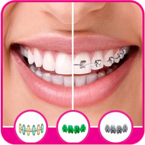 Braces Stickers Photo Editor: A Comprehensive Guide to Creating Fun Camera Effects